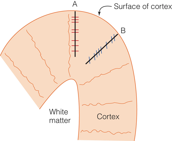 Image:04orientation column.png