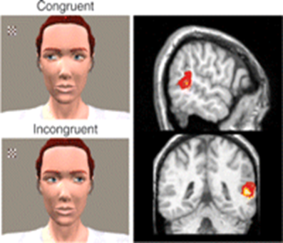 Image:06Superior Temporal Sulcus STS.png