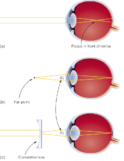 Image:02the eye and image4.png