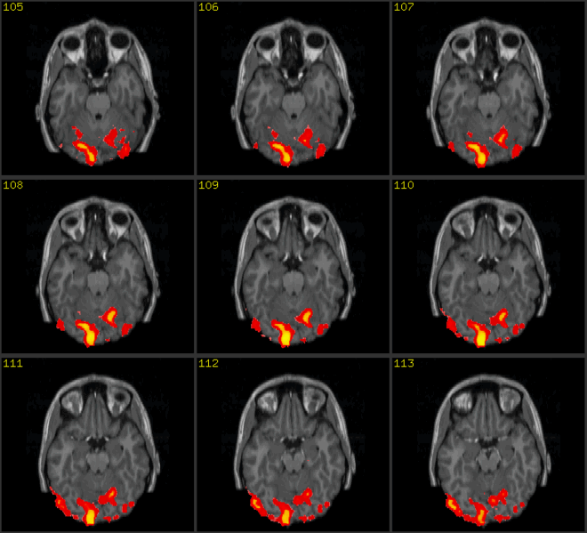 Image:Fmri.h2.gif